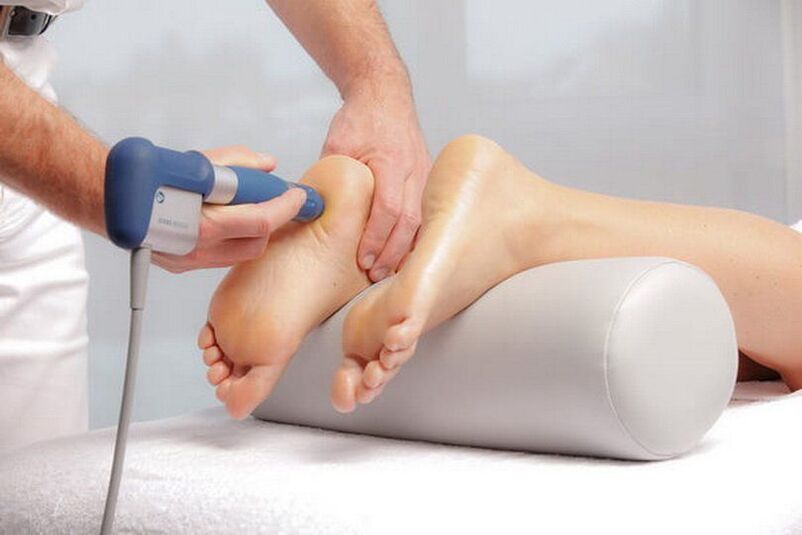 Šoka viļņu terapijas veikšana