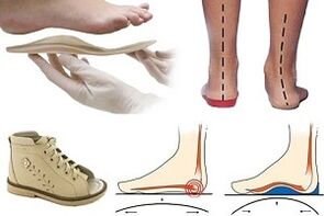 ortopēdiskie apavi hallux valgus bērnam