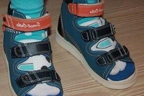 valkājot sandales hallux valgus bērnam