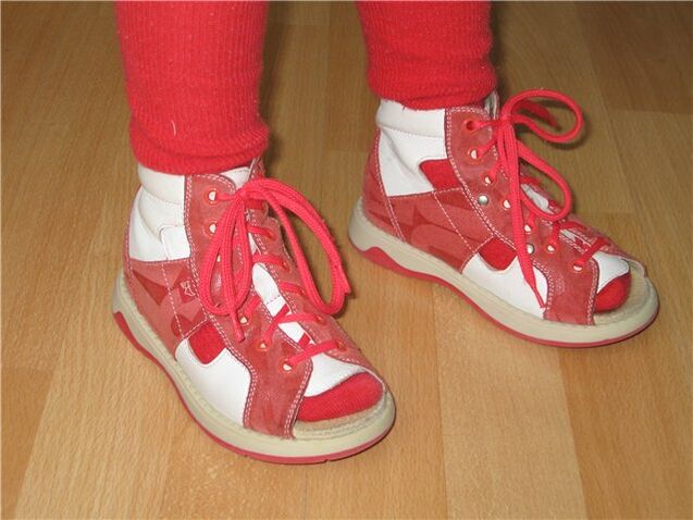 apavi bērniem ar hallux valgus